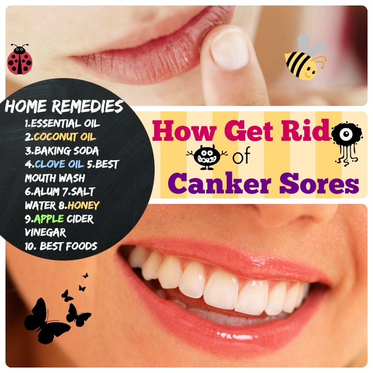 10 Home Remedies for Canker Sores Happy Lips