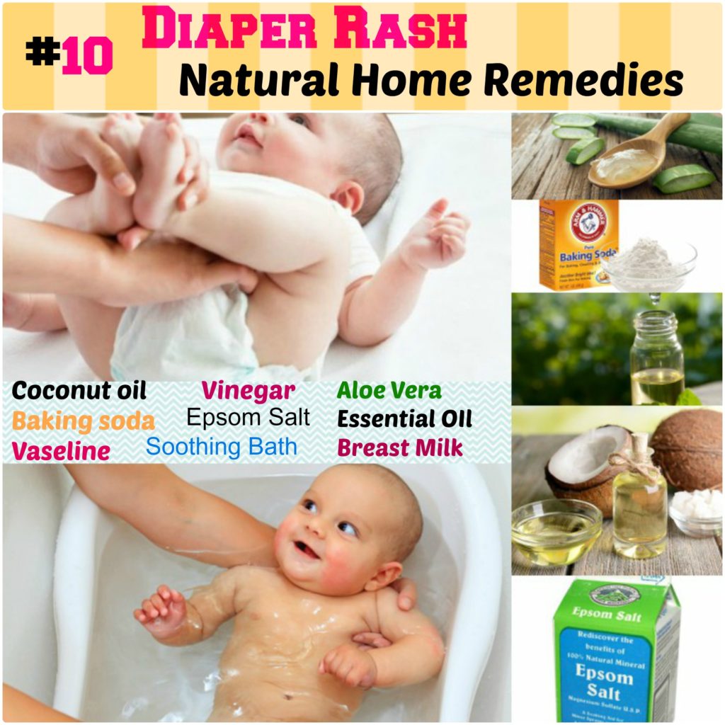 Natural Home Remdies for Baby Diaper Rash