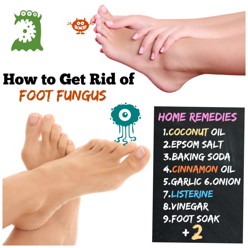 how-to-get-rid-of-foot-fungus