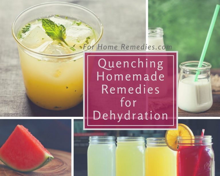 Combat Dehydration 5 Best Foods & Home Remedies to Stay Hydrated