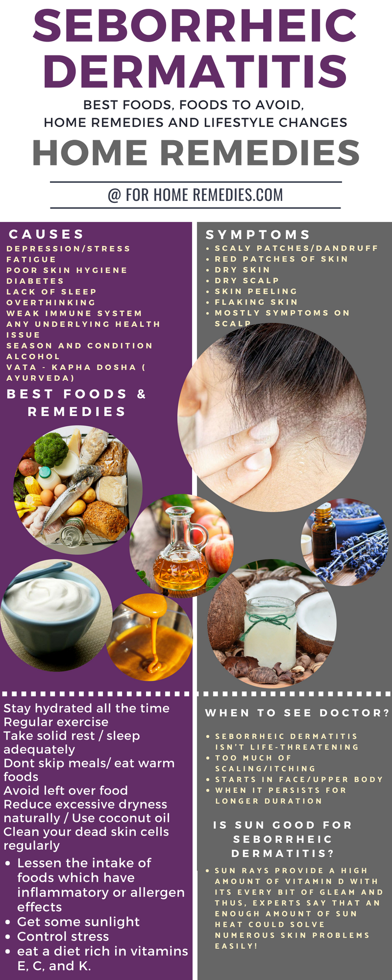 9 Quick Home Remedies And Best Foods To Heal Seborrheic Dermatitis