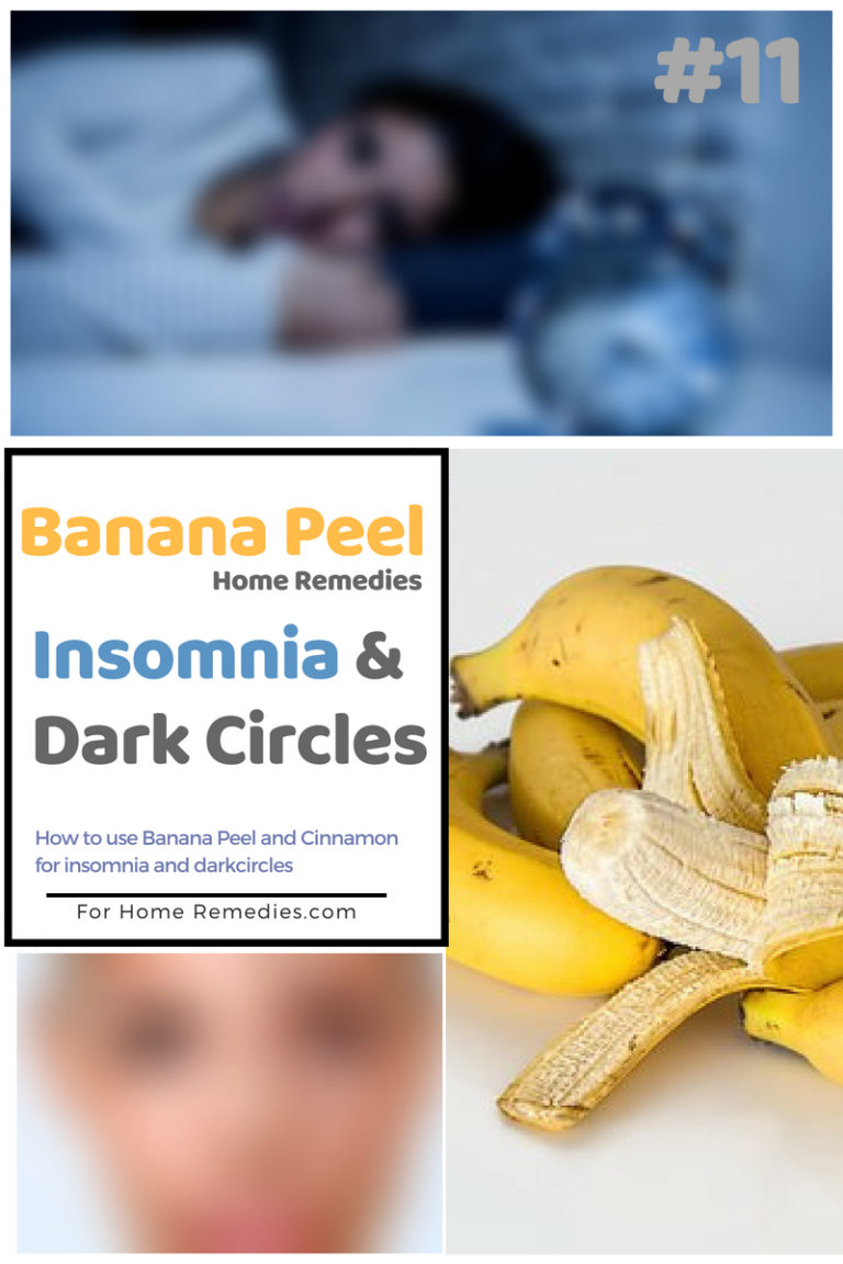 How to Use Banana Peel for Dark Circle and Insomnia ( Effective )
