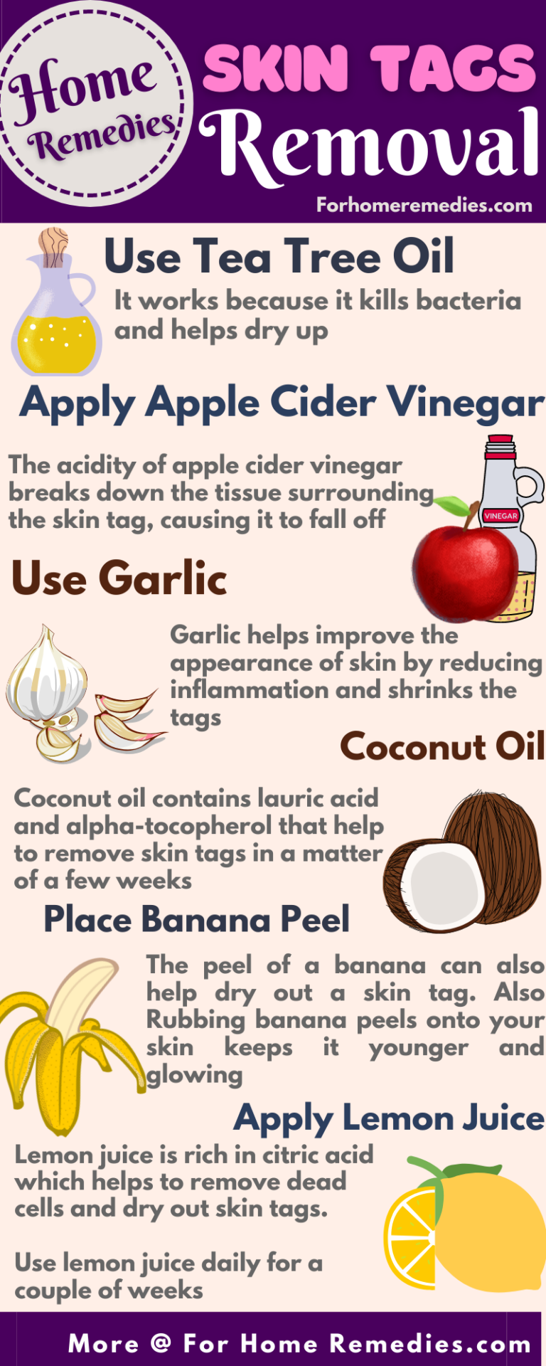 Quick & Easy Home Remedies for Skin Tags Removal ForHomeRemedies