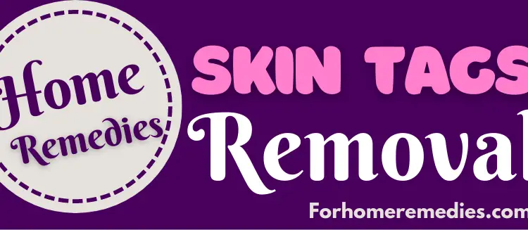 Quick and Easy Home Remedies for Skin Tags